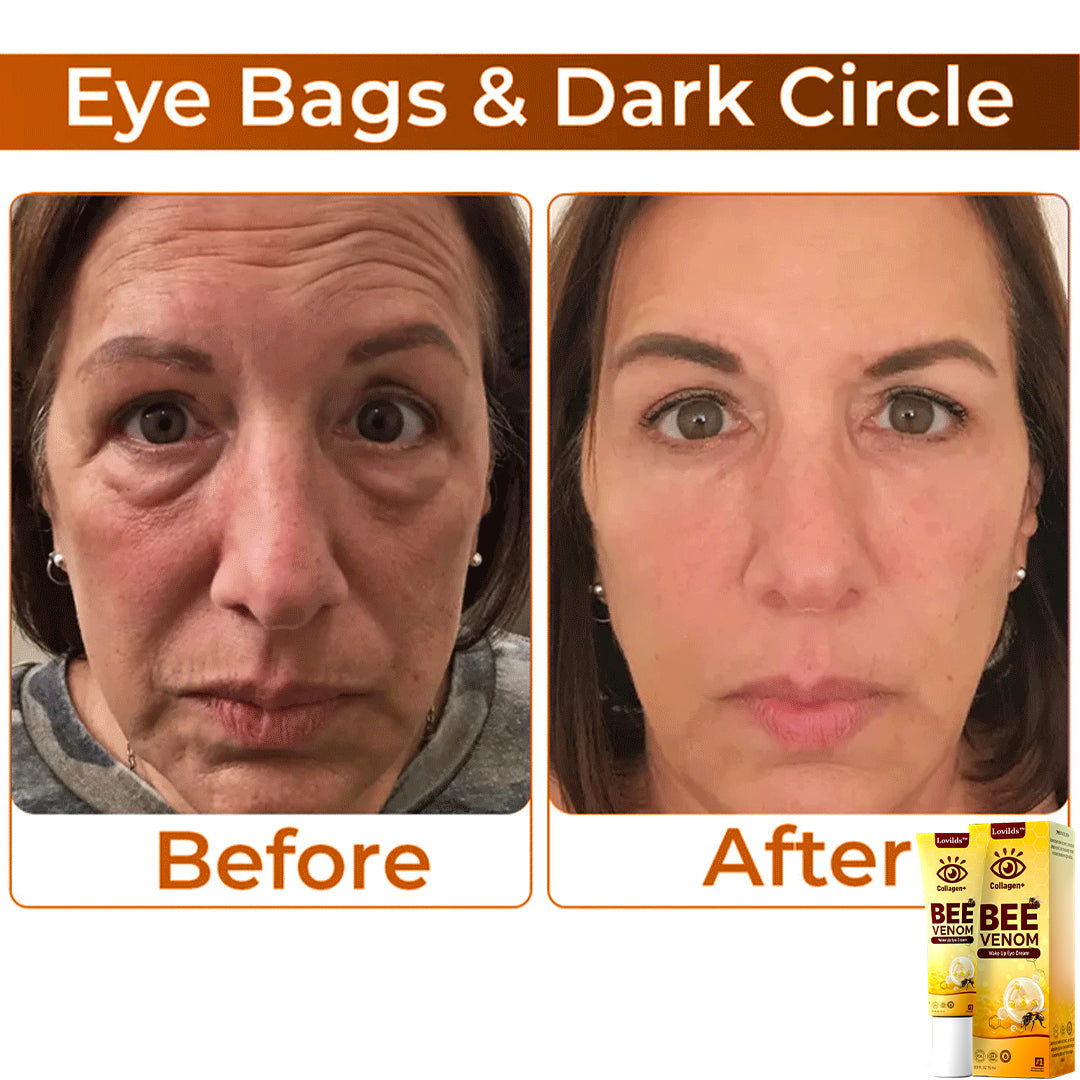 🌼 LOVILDS™ Collagen+ Bee Venom Anti-Aging Cream 🇺🇸 Dermatologist Recommended