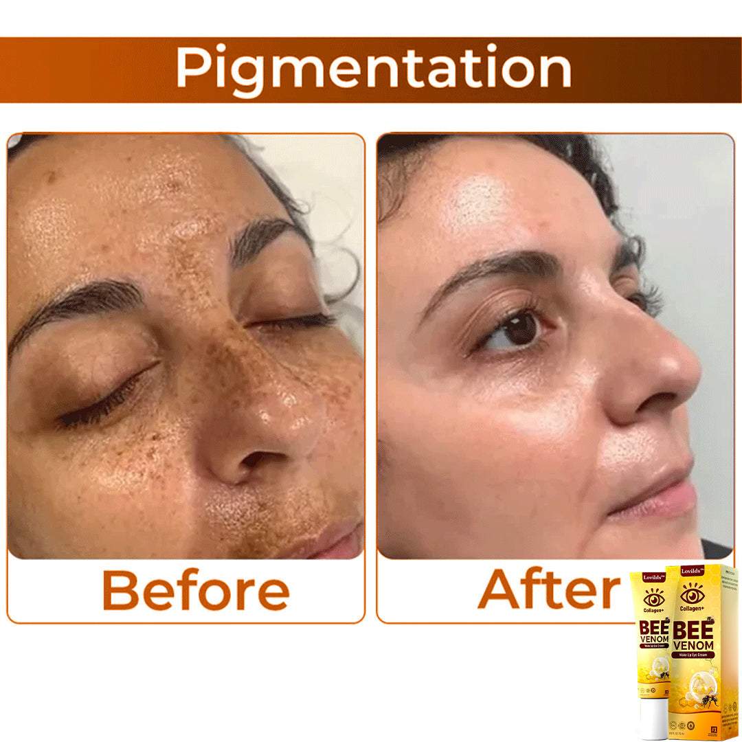 🌼 LOVILDS™ Collagen+ Bee Venom Anti-Aging Cream 🇺🇸 Dermatologist Recommended
