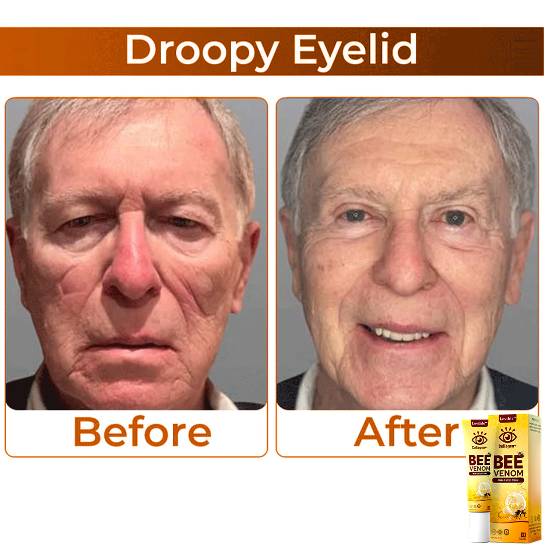 🌼 LOVILDS™ Collagen+ Bee Venom Anti-Aging Cream 🇺🇸 Dermatologist Recommended