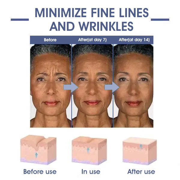 ✨🩵𝐋𝐚𝐬𝐭 𝐃𝐚𝐲 𝐃𝐢𝐬𝐜𝐨𝐮𝐧𝐭: 87% 𝐎𝐅𝐅🌸LOVILDS® 𝐀𝐝𝐯𝐚𝐧𝐜𝐞𝐝 𝐅𝐢𝐫𝐦𝐢𝐧𝐠 & 𝐖𝐫𝐢𝐧𝐤𝐥𝐞-𝐑𝐞𝐝𝐮𝐜𝐢𝐧𝐠 𝐂𝐫𝐞𝐚𝐦: Restore Skin Elasticity⭐