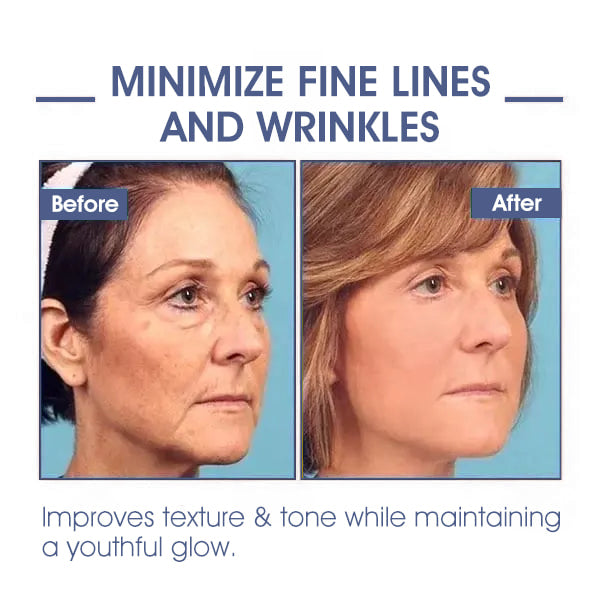 ✨🩵𝐋𝐚𝐬𝐭 𝐃𝐚𝐲 𝐃𝐢𝐬𝐜𝐨𝐮𝐧𝐭: 87% 𝐎𝐅𝐅🌸LOVILDS® 𝐀𝐝𝐯𝐚𝐧𝐜𝐞𝐝 𝐅𝐢𝐫𝐦𝐢𝐧𝐠 & 𝐖𝐫𝐢𝐧𝐤𝐥𝐞-𝐑𝐞𝐝𝐮𝐜𝐢𝐧𝐠 𝐂𝐫𝐞𝐚𝐦: Restore Skin Elasticity⭐