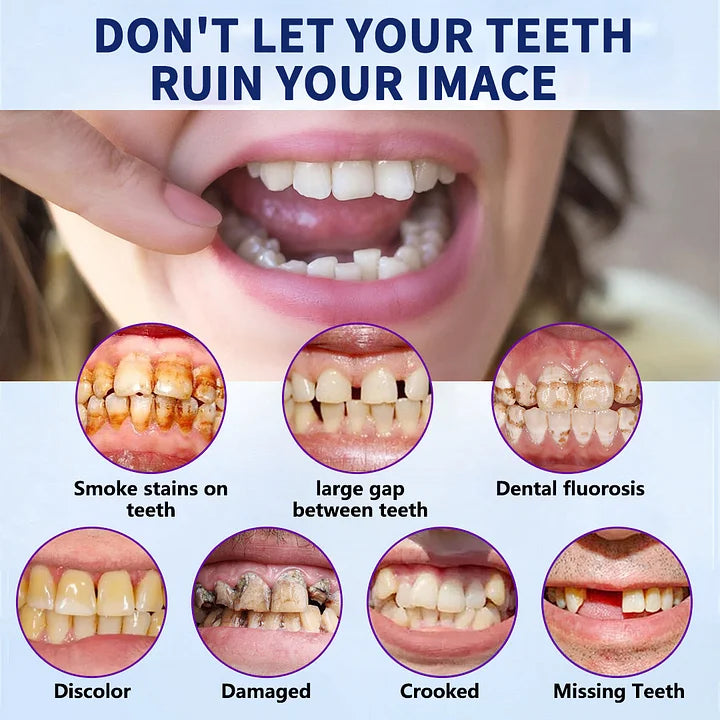 NESLEMYâ˘-Advanced Customized Full Denture Set