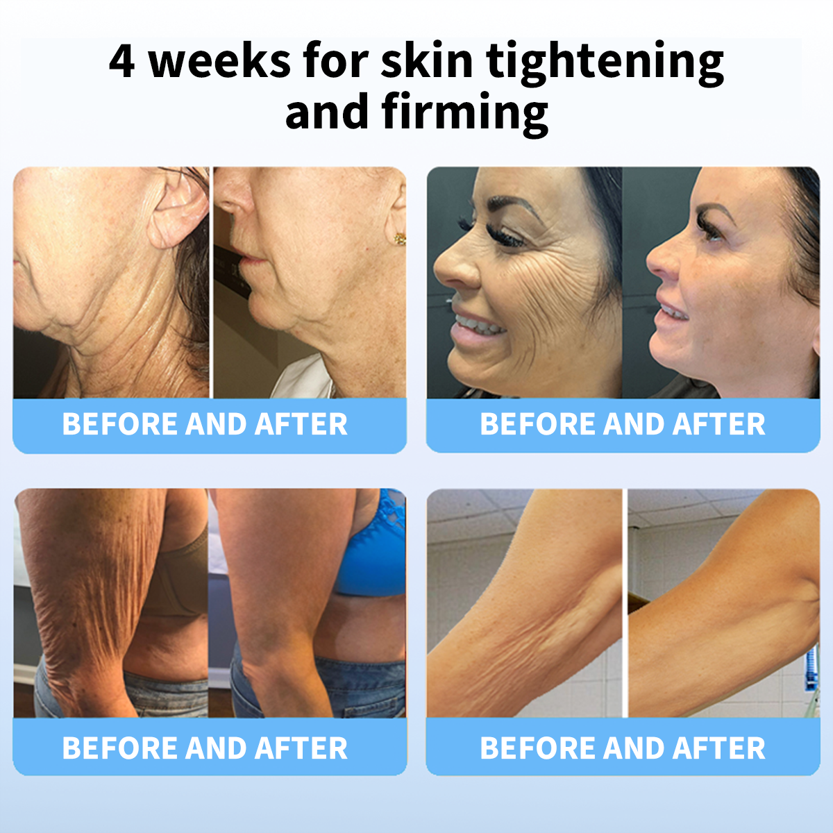 ✨🩵𝐋𝐚𝐬𝐭 𝐃𝐚𝐲 𝐃𝐢𝐬𝐜𝐨𝐮𝐧𝐭: 87% 𝐎𝐅𝐅🌸LOVILDS® 𝐀𝐝𝐯𝐚𝐧𝐜𝐞𝐝 𝐅𝐢𝐫𝐦𝐢𝐧𝐠 & 𝐖𝐫𝐢𝐧𝐤𝐥𝐞-𝐑𝐞𝐝𝐮𝐜𝐢𝐧𝐠 𝐂𝐫𝐞𝐚𝐦: Restore Skin Elasticity⭐