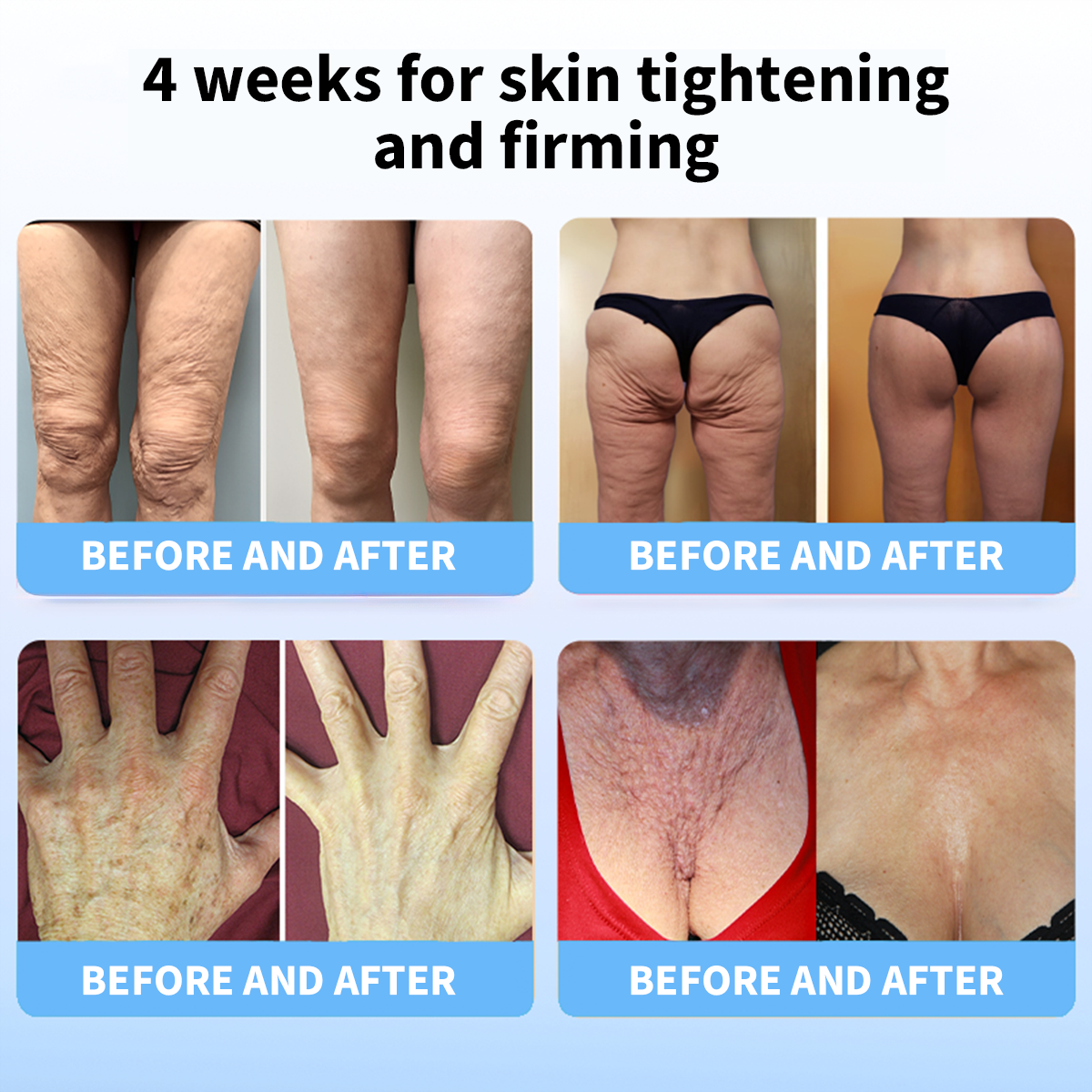 ✨🩵𝐋𝐚𝐬𝐭 𝐃𝐚𝐲 𝐃𝐢𝐬𝐜𝐨𝐮𝐧𝐭: 87% 𝐎𝐅𝐅🌸LOVILDS® 𝐀𝐝𝐯𝐚𝐧𝐜𝐞𝐝 𝐅𝐢𝐫𝐦𝐢𝐧𝐠 & 𝐖𝐫𝐢𝐧𝐤𝐥𝐞-𝐑𝐞𝐝𝐮𝐜𝐢𝐧𝐠 𝐂𝐫𝐞𝐚𝐦: Restore Skin Elasticity⭐