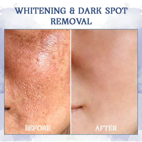✨🩵𝐋𝐚𝐬𝐭 𝐃𝐚𝐲 𝐃𝐢𝐬𝐜𝐨𝐮𝐧𝐭: 87% 𝐎𝐅𝐅🌸LOVILDS® 𝐀𝐝𝐯𝐚𝐧𝐜𝐞𝐝 𝐅𝐢𝐫𝐦𝐢𝐧𝐠 & 𝐖𝐫𝐢𝐧𝐤𝐥𝐞-𝐑𝐞𝐝𝐮𝐜𝐢𝐧𝐠 𝐂𝐫𝐞𝐚𝐦: Restore Skin Elasticity⭐
