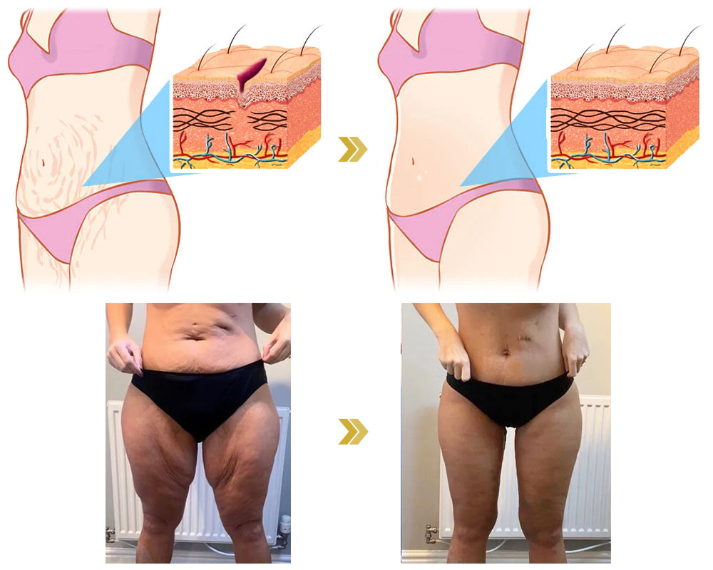 ✨🩵𝐋𝐚𝐬𝐭 𝐃𝐚𝐲 𝐃𝐢𝐬𝐜𝐨𝐮𝐧𝐭: 87% 𝐎𝐅𝐅🌸LOVILDS® 𝐀𝐝𝐯𝐚𝐧𝐜𝐞𝐝 𝐅𝐢𝐫𝐦𝐢𝐧𝐠 & 𝐖𝐫𝐢𝐧𝐤𝐥𝐞-𝐑𝐞𝐝𝐮𝐜𝐢𝐧𝐠 𝐂𝐫𝐞𝐚𝐦: Restore Skin Elasticity⭐