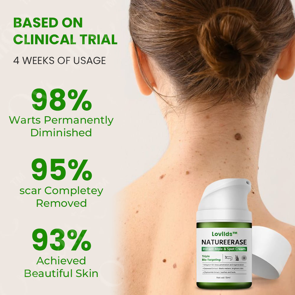 ✅Official Store: LOVILDS™ NatureErase Instant Mole & Spot Cream