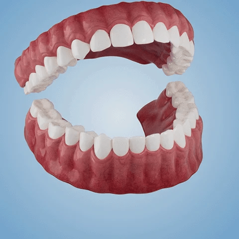 NESLEMYâ˘-Advanced Customized Full Denture Set