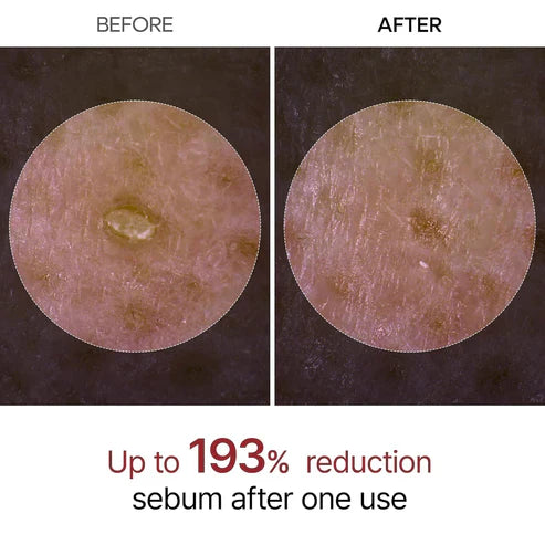 Final 3 Hours: 60% OFF🔥 Peel Shot