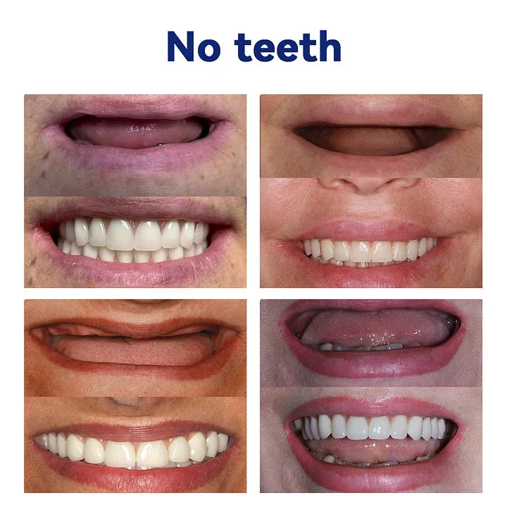 NESLEMYâ˘-Advanced Customized Full Denture Set