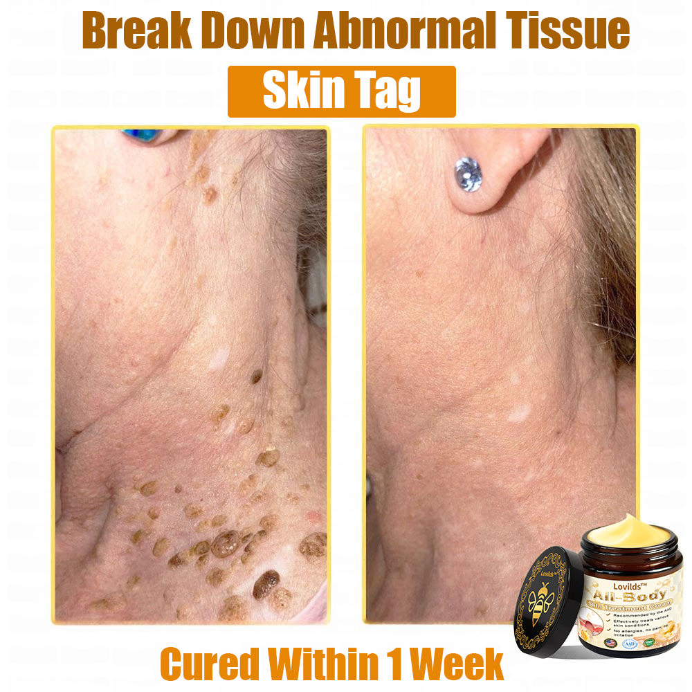 LOVILDS™ Bee Venom All-in-One Cream US Dermatologist Approved