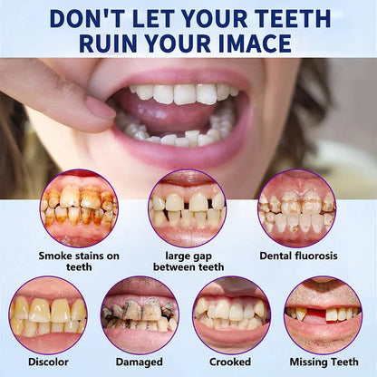 NESLEMY™-Advanced Customized Full Denture Set