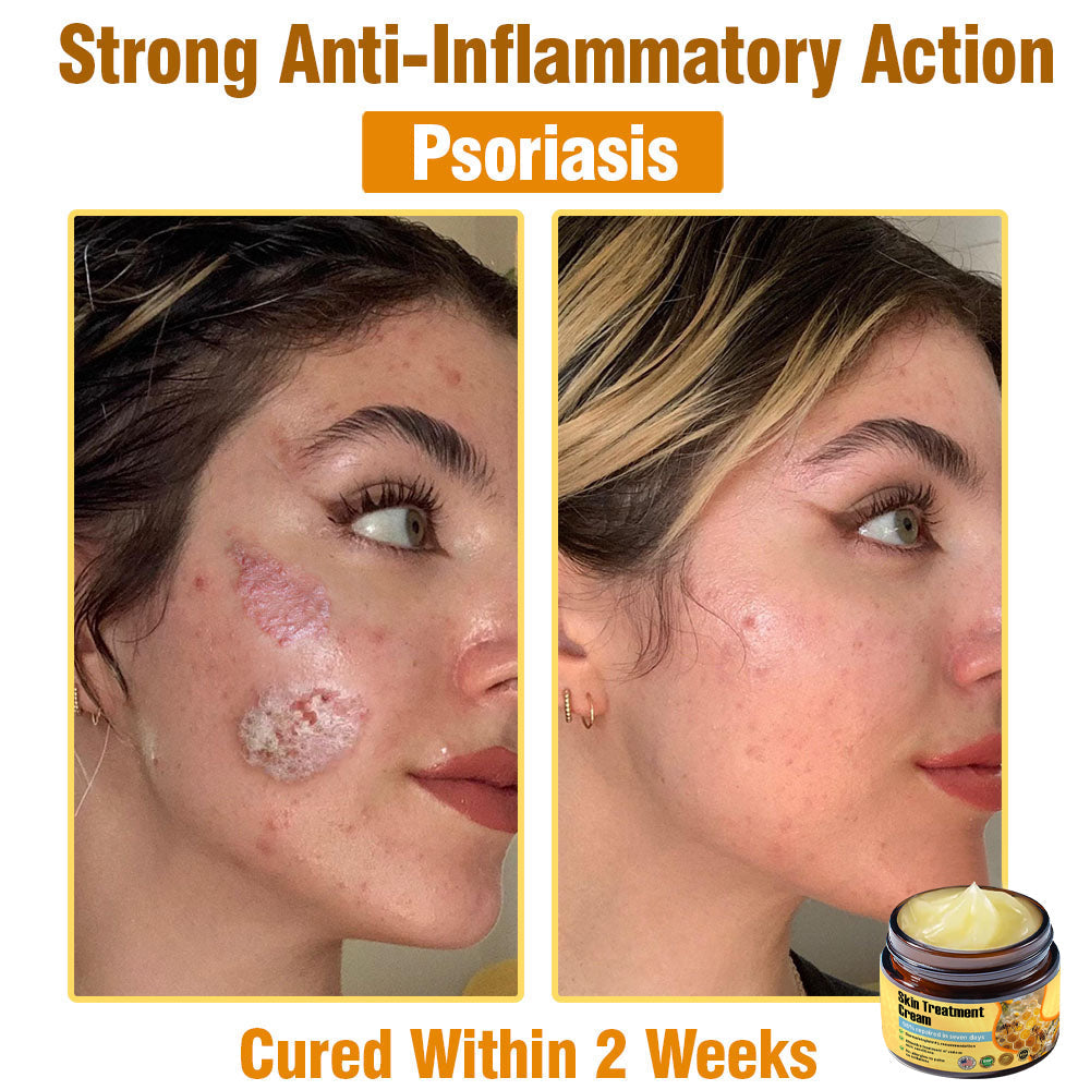✅Official Store TF02: 7-Day Multi-Effect All-in-One Skincare Cream (👨‍⚕️AAD Recommended🌼)