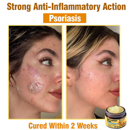 ✅Official Store TF02: 7-Day Multi-Effect All-in-One Skincare Cream (👨‍⚕️AAD Recommended🌼)