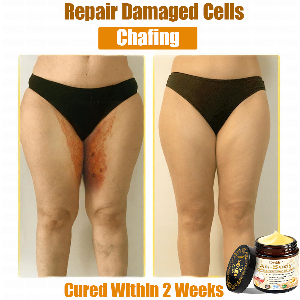 LOVILDS™ Bee Venom All-in-One Cream US Dermatologist Approved