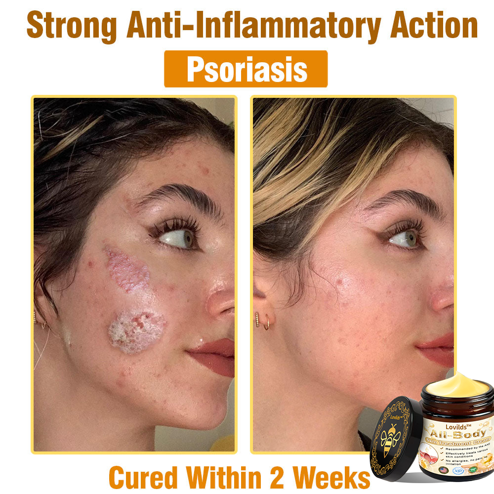 LOVILDS™ Bee Venom All-in-One Cream US Dermatologist Approved