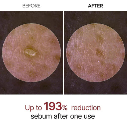 Final 3 Hours: 60% OFF🔥 Peel Shot