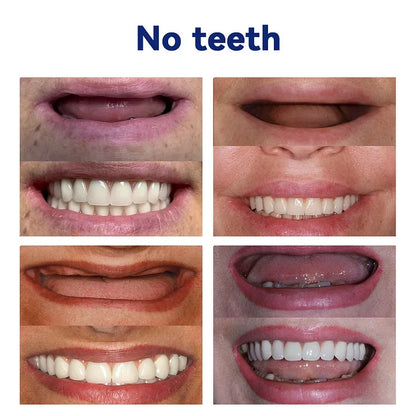 NESLEMY™-Advanced Customized Full Denture Set