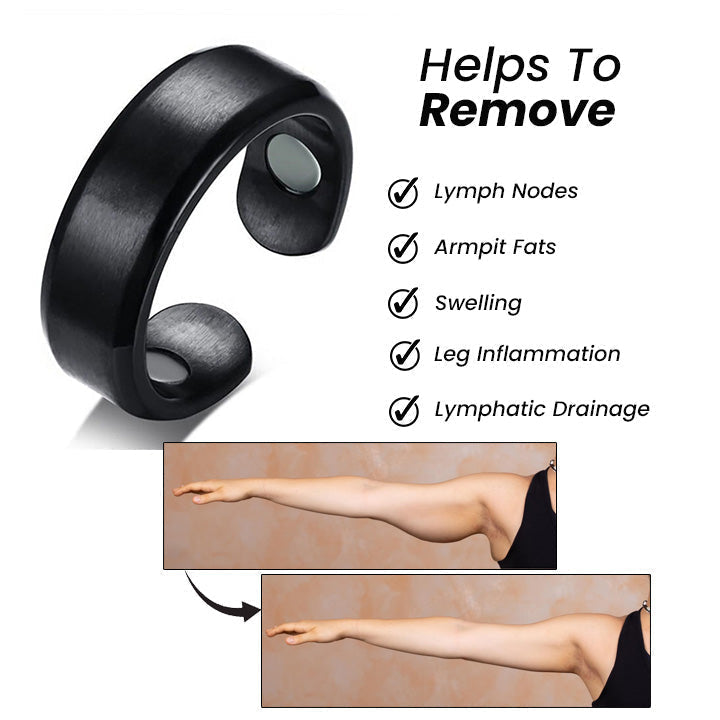 Magnetic Lymphatic Drainage Therapeutic Ring(Flash Sale: Free Worldwide Shipping Today! 🌎)